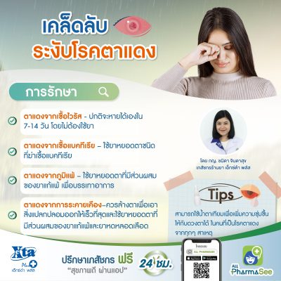 info-เคล็ดลับ ระงับโรค ตาแดง 